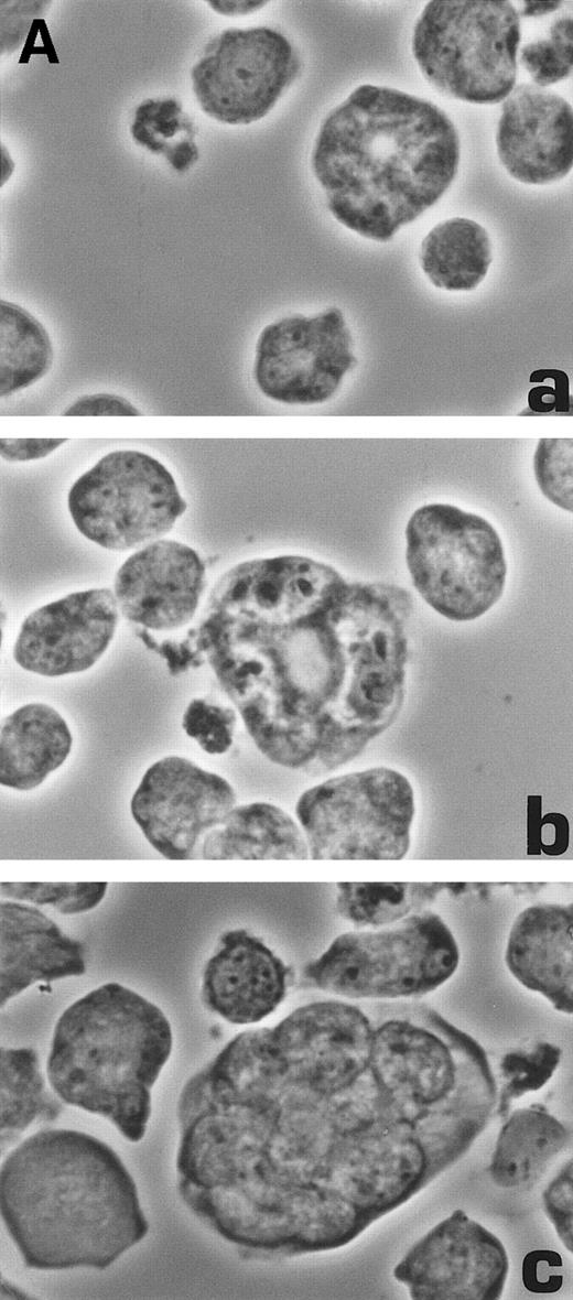 Fig. 6. Morphological characterization of enlarged (diameter, >20 μm) cells from HHV-7–infected SupT1 cultures. (A) Light micrographs showing cells with a progressively increasing size (a through c) having prominent and lobulated nucleus. (B) Light micrographs of serial semithin (1 μm) plastic sections of the same cells. Note that the multiple nuclear sections evident in panel c belong to the same irregular nucleus shown in panels a and b. (C) Confocal microscope images of the nucleus of a giant HHV-7–infected cell after staining of the DNA with propidium iodide. (a through c) Confocal sections were taken 0.5 μm apart. Whereas two nuclear lobes were clearly separated in panel a, they appeared connected by a nuclear bridge in successive sections (panels b and c). In (B) and (C), the arrow shows the same point in different sections. Original magnification in (A) and (B) × 400; in (C) × 1,000.