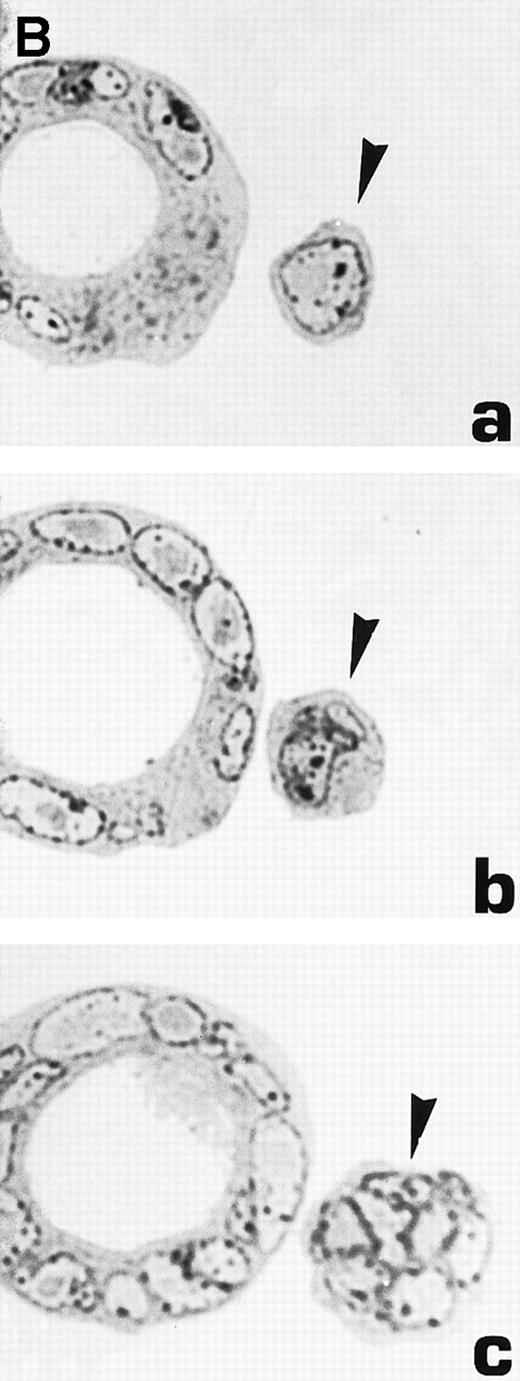 Fig. 6. Morphological characterization of enlarged (diameter, >20 μm) cells from HHV-7–infected SupT1 cultures. (A) Light micrographs showing cells with a progressively increasing size (a through c) having prominent and lobulated nucleus. (B) Light micrographs of serial semithin (1 μm) plastic sections of the same cells. Note that the multiple nuclear sections evident in panel c belong to the same irregular nucleus shown in panels a and b. (C) Confocal microscope images of the nucleus of a giant HHV-7–infected cell after staining of the DNA with propidium iodide. (a through c) Confocal sections were taken 0.5 μm apart. Whereas two nuclear lobes were clearly separated in panel a, they appeared connected by a nuclear bridge in successive sections (panels b and c). In (B) and (C), the arrow shows the same point in different sections. Original magnification in (A) and (B) × 400; in (C) × 1,000.