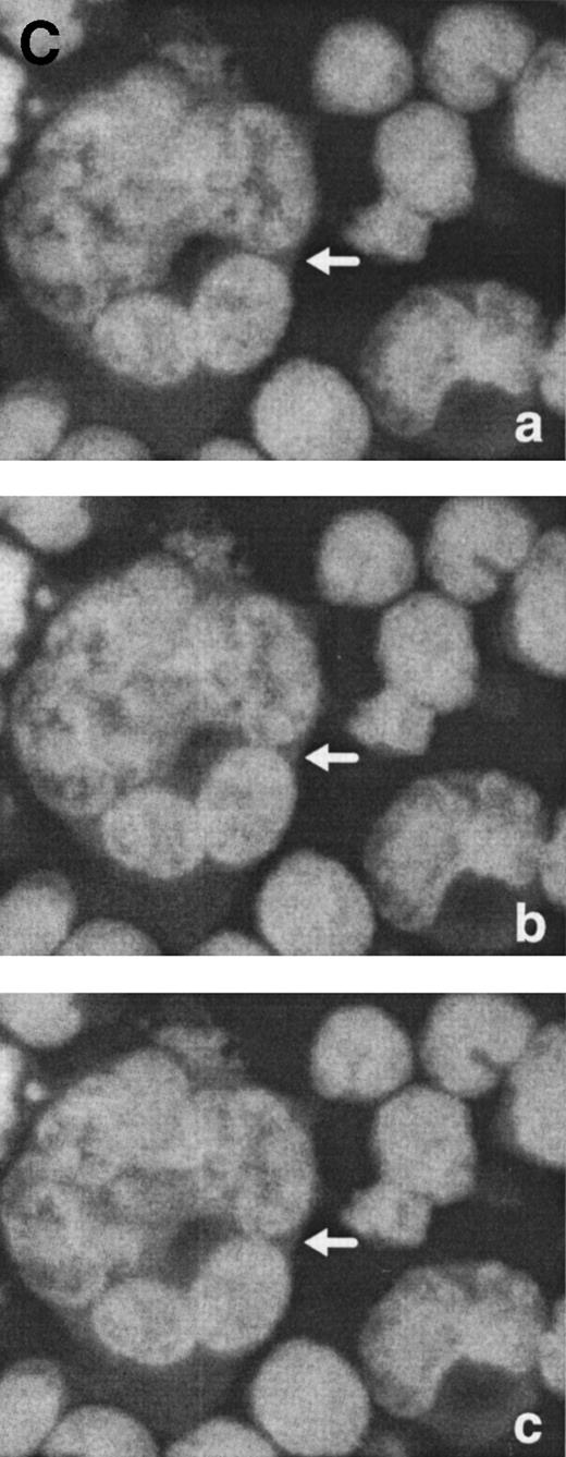 Fig. 6. Morphological characterization of enlarged (diameter, >20 μm) cells from HHV-7–infected SupT1 cultures. (A) Light micrographs showing cells with a progressively increasing size (a through c) having prominent and lobulated nucleus. (B) Light micrographs of serial semithin (1 μm) plastic sections of the same cells. Note that the multiple nuclear sections evident in panel c belong to the same irregular nucleus shown in panels a and b. (C) Confocal microscope images of the nucleus of a giant HHV-7–infected cell after staining of the DNA with propidium iodide. (a through c) Confocal sections were taken 0.5 μm apart. Whereas two nuclear lobes were clearly separated in panel a, they appeared connected by a nuclear bridge in successive sections (panels b and c). In (B) and (C), the arrow shows the same point in different sections. Original magnification in (A) and (B) × 400; in (C) × 1,000.