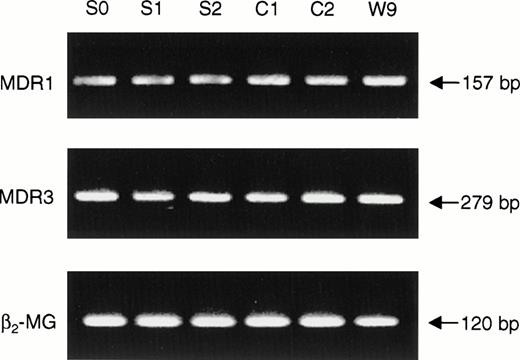 Fig. 1. Expression of MDR genes in Scott and normal control EBV-transformed B lymphocytes. RNA was extracted from three EBV-transformed B-lymphoblast cell lines derived from a patient with Scott syndrome (S0, S1, S2) and three normal volunteers (C1, C2, W9), and RT-PCR performed with primers specific for MDR1, MDR3, and β2-microglobulin (control gene), respectively. PCR products were separated by agarose gel electrophoresis and visualized by ethidium bromide staining. See Materials and Methods for details.