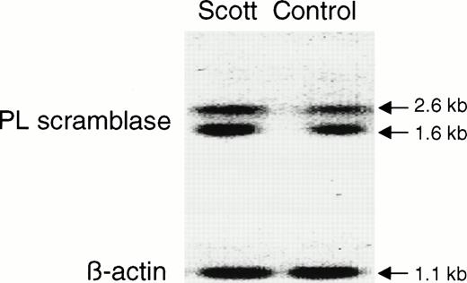 Fig. 3. Northern blot analysis of PL scramblase in Scott and normal B lymphoblasts. RNA was extracted from Scott and normal control B lymphoblasts, and Northern blot performed with32P-labeled PL scramblase cDNA probe as described in Materials and Methods. Results are shown for Scott S2 and normal control W9 (upper panel). Comparable amounts of transcripts were observed for all cell lines tested. Lower panel shows Northern blot of β-actin.