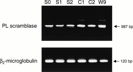 Fig. 4. RT-PCR analysis of PL scramblase in Scott and normal B lymphoblasts. RNA was extracted from three Scott (S0, S1, S2) and three normal control (C1, C2, W9) B-lymphoblast cell lines and RT-PCR performed with PL scramblase-specific primers. PCR products were separated by agarose gel electrophoresis and visualized by ethidium bromide staining. See Materials and Methods for details. RT-PCR of β2-microglobulin as control gene is also shown.
