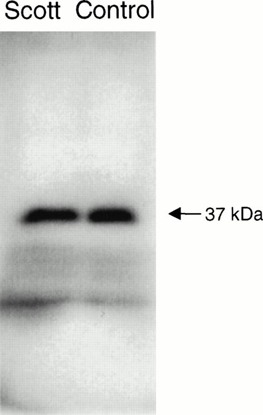 Fig. 5. Western blot of PL scramblase in Scott and normal B lymphoblasts. Lysates of Scott and normal B lymphoblasts were subjected to SDS-PAGE, transferred to nitrocellulose, and the blot was developed with 10 μg/mL of rabbit anti-PL scramblase-E306-W318 raised against the C-terminal peptide of PL scramblase. See Materials and Methods for details.
