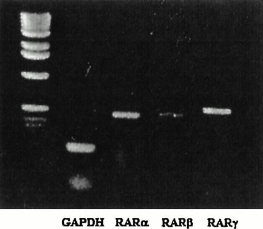 Fig. 6. Expression of RAR in peripheral human B cells. Human peripheral B cells were isolated and mRNA was extracted. RAR-specific (, β, and γ) and GADPH transcripts were assessed by semiquantitative RT-PCR. The DNA ladder is shown in the left lane.
