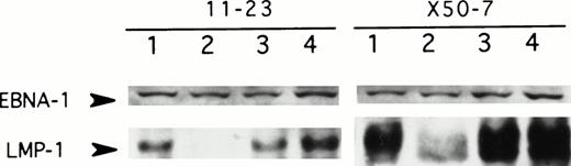 Fig. 1. LMP-1 antisense oligodeoxynucleotide treatment suppresses LMP-1 protein levels. Western blot analysis of LMP-1 and EBNA-1 protein expression in 2 EBV-positive lymphoblastoid cell lines, 11-23 and X50-7, was performed after exposure to unmodified antisense oligodeoxynucleotide targeted to LMP-1 (codons 1 through 5) for 48 hours. Lane 1, untreated control; lane 2, LMP-1 antisense-treated (50 μmol/L); lane 3, LMP-1 antisense-treated (5 μmol/L); lane 4, control oligodeoxynucleotide (SS1)-treated (50 μmol/L). Duplicate sets of samples for each condition were immunoblotted for LMP-1 or EBNA-1, as described in the Methods.