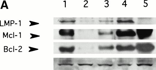 Fig. 2. LMP-1 antisense oligodeoxynucleotide treatment suppresses LMP-1–inducible antiapoptotic genes, Bcl-2 and Mcl-1. Western blot analysis of LMP-1, Bcl-2, and Mcl-1 expression in the EBV-positive lymphoblastoid cell line, X50-7, was performed after exposure to oligodeoxynucleotide (10 μmol/L in the presence of liposomes) for 48 (A) or 72 (B) hours. Lanes 1, untreated control cultured in liposomes; lanes 2, antisense-treated; lanes 3, control oligodeoxynucleotide (SS2)-treated; lane 4, untreated control cultured without liposomes; lane 5, untreated EBV-negative B-cell line, Louckes. Blots were sequentially exposed to anti–LMP-1 antibody, anti–Bcl-2 antibody, and anti–Mcl-1 antibody. Bottom panel shows a representative nonspecific high–molecular-weight band seen on prolonged exposure of the blot using LMP-1 antibody, confirming approximately equivalent amounts of protein loaded per lane.