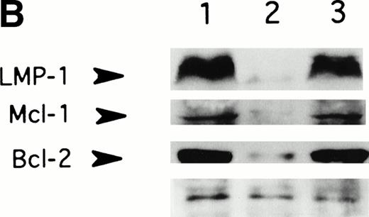 Fig. 2. LMP-1 antisense oligodeoxynucleotide treatment suppresses LMP-1–inducible antiapoptotic genes, Bcl-2 and Mcl-1. Western blot analysis of LMP-1, Bcl-2, and Mcl-1 expression in the EBV-positive lymphoblastoid cell line, X50-7, was performed after exposure to oligodeoxynucleotide (10 μmol/L in the presence of liposomes) for 48 (A) or 72 (B) hours. Lanes 1, untreated control cultured in liposomes; lanes 2, antisense-treated; lanes 3, control oligodeoxynucleotide (SS2)-treated; lane 4, untreated control cultured without liposomes; lane 5, untreated EBV-negative B-cell line, Louckes. Blots were sequentially exposed to anti–LMP-1 antibody, anti–Bcl-2 antibody, and anti–Mcl-1 antibody. Bottom panel shows a representative nonspecific high–molecular-weight band seen on prolonged exposure of the blot using LMP-1 antibody, confirming approximately equivalent amounts of protein loaded per lane.