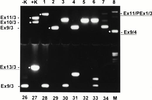 Fig. 2. Ethidium bromide–stained agarose gel with nested RT-PCR products of normal donor blood (samples 1 to 8 and 26 to 34). −K, blank control; +K, AML with MLL duplication; M, molecular weight standard (Boehringer no. VI). Exon fusions are indicated at the left and right. New characterized fusions are underlined.