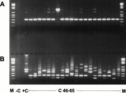 Fig. 3. Nested RT-PCR products of the second experiment. (A) ABL PCR; (B) nested PCR for MLL duplication AML with MLL duplication. M, molecular weight standard (Boehringer no. VI); −C, blank control; +C, AML with MLL-duplication; C46-65, pheripheral blood of healthy controls no. 46 to 65.