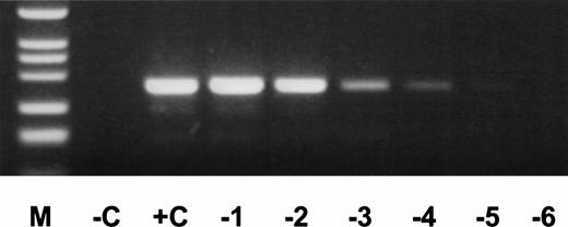 Fig. 5. cDNA of AML positive for an exon 10/exon 3 duplication transcript was diluted into mouse liver cDNA at concentrations ranging from 100 to 10−5 (0 to −5) and MLL-duplication transcripts were amplified by nested PCR. For each experiment, cDNA of ∼−25,000 cells was used. Description of other lanes as in Fig 2.