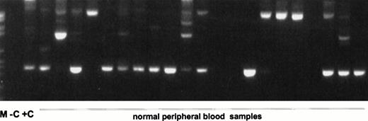 Fig. 7. Genomic amplification of the duplications using intron 9 and intron 1 primers. M, molecular weight standard; −C, blank control; +C, AML with MLL duplication.