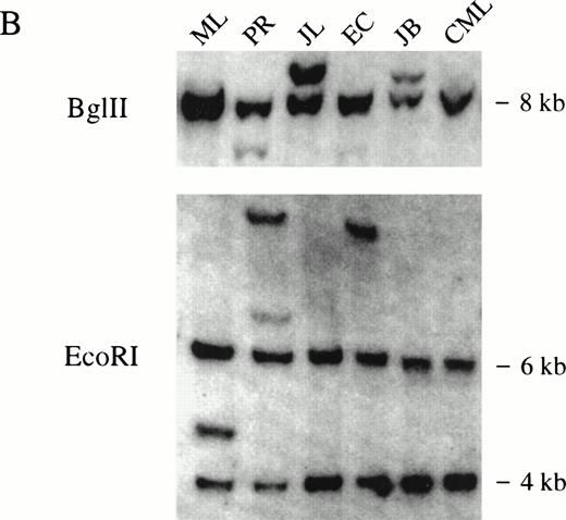 Fig. 3. (A) Multiple tissue Northern blot probed with ZNF198 and β-actin. A major ZNF198 transcript of 5.0 kb and a minor transcript of 8.0 kb is seen in all tissues tested. (B) Southern blot ofBglII or EcoRI digested patient and control (CML) DNA probed with ZNF198. Rearrangements are seen for all five patients.