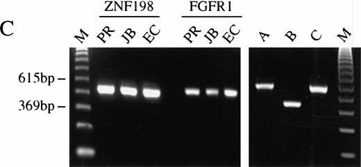 Fig. 5. (A) The sequence surrounding the ZNF198-FGFR1 fusion. Proline 913 of ZNF198 is joined to valine 429 of FGFR1.39FGFR1 sequence is underlined. (B) RT-PCR analysis showing the presence of ZNF198-FGFR1 fusion transcripts (578 bp) in patients P.R., J.B., and E.C. but not three patients with CML. Reciprocal FGFR1-ZNF198 transcripts were not detected in any individual. M, 123-bp ladder. (C) (i) Expression of normal ZNF198 (527 bp) and normal FGFR1 (534 bp) in patients P.R., J.B., and E.C. (ii) RT-PCR using (A) primers DET22 + DET26 (564 bp), (B) DET17 + DET26 (395 bp), and (C) DET17 + DET22 + DET26 (564 bp).