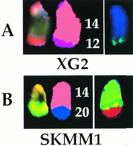 Fig. 4. The t(12;14) (A) and t(14;20) (B) translocations analyzed by SKY and whole chromosome painting. In each case, from left to right are shown the SKY (display and spectral classification) and whole chromosome painted images of the der (14) chromosomes.
