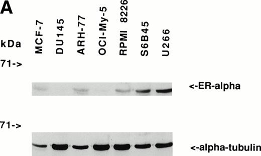 Fig. 1. Expression of estrogen receptor on MM cell lines and MM patient cells. Lysates from ARH-77, OCI My-5, RPMI 8226, S6B45, and U266 MM cells (A) as well as purified MM cells from 3 patients (B) were examined by Western immunoblotting for the presence of ER- using the TE1115011 MoAb. MCF-7 breast cancer cells and DU145 prostatic cancer cells served as positive and negative controls, respectively, for ER- expression. Immunoblotting with anti–tubulin- MoAb assured equivalent protein loading.