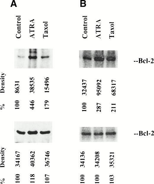 Fig. 4. Metabolic labeling of bcl-2 from OCI/AML-5 cells in vivo (left) and in vitro (right). Radioautographs of labeled protein from control, ATRA-treated and taxol-treated cells, separated by 12.5% SDS-PAGE are shown at the top. Densitometer readings are shown. At the bottom, Western blots of the lysates, stained with anti–bcl-2, are shown. Such Western blots, prepared after 12.5% SDS-PAGE, show bcl-2 from taxol-treated cells only as a single band.
