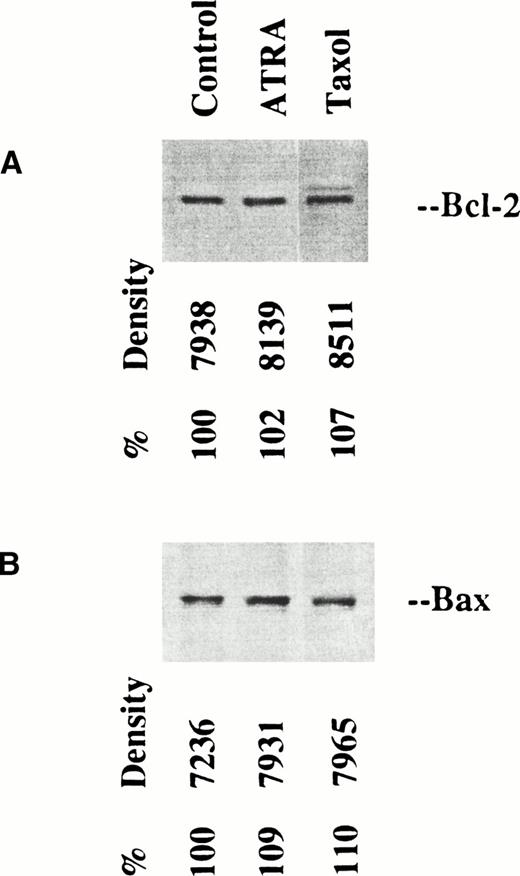 Fig. 7. 10% to 20% gradient gels after bcl-2 immunoprecipitation of lysates from OCI/AML-5 cells, as controls or after treatment with ATRA or taxol. The panel at the top shows the immunoprecipitates, stained with anti–bcl-2. The bottom panels show the supernatants, stained with anti-bax. It is seen that treatment of the OCI/AML-5 cells did not change the amount of bax that did not coprecipitate with bcl-2.