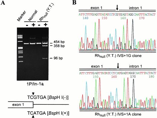 Fig. 5. Heterozygosity for the splicing donor mutation as shown by Bsp HI analysis and subcloning. (A) Restriction digestion of genomic segments 1P/In-1a by Bsp HI. Lanes 1 and 2, normal; lanes 3 and 4, Rhnull (YT). (−), uncut; and (+),Bsp HI cut. Note that no digestion is seen in controls. For Rhnull (YT), the size of the uncleaved fragment from the Rh50(836A) allele and the two smaller fragments expected of the Rh50(836G) allele is indicated. Shown schematically at the bottom are the wild-type or mutant exon 1/intron 1 boundary (triangles) and recognition sequence of Bsp HI. (B) Sequencing profiles of the subcloned fragments 1P/In-1a from Rhnull (YT). Two types of the inserts that carry either the G or A residue at +1 position of intron 1 (IVS) were identified, confirming the proband to be heterozygous for the splice donor mutation.