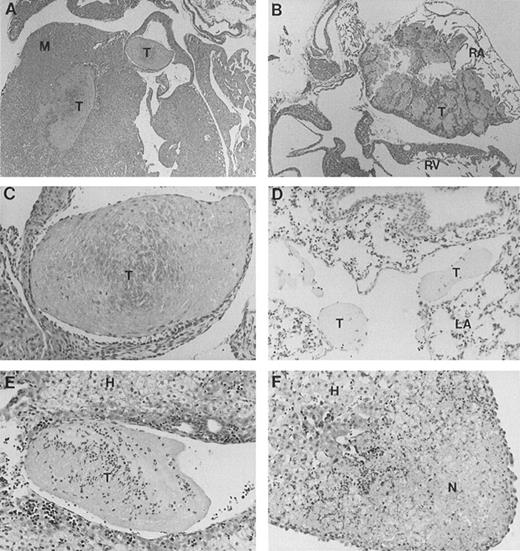Fig. 1. Histopathologic analysis of band 3 null mice. Band 3 null pups and organs from band 3 null adult mice were fixed in buffered formalin for histopathologic examination. Tissues were stained with hematoxylin and eosin. (A and B) (original magnification × 20) show characteristic thrombi in the atrial and ventricular cavities. Similar lesions were observed in nine of 12 mice examined. A higher magnification of one thrombus in (C) (original magnification × 60) clearly shows endothelial lining of the organized thrombus, indicating premortem development of the lesion. (D) (original magnification × 40) shows two thrombi in a medium-size vessel in the lung parenchyma. (E) (original magnification × 40) shows a large organized thrombus in the portal vein in one adult band 3 null mouse. (F) (original magnification × 40) shows a liver section from a band 3 null pup revealing subcapsular hepatocellular necrosis suggesting an ischemic event due to a small arterial occlusion. M, myocardium; T, thrombus; RA, right atrium; RV, right ventricle; LA, lung alveoli; H, hepatocytes; N, necrosis.