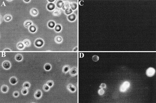 Fig. 4. Fluorescence microscopy analysis of FITC-annexin V binding to RBCs. RBCs were examined after 36 hours of incubation in PBS to facilitate the detection of abnormal cells due to progressive loss of phospholipid asymmetry. Washed RBCs were incubated with FITC-annexin V at room temperature. After two washings in PBS, RBCs were collected by centrifugation at 1,000g and placed between siliconized slide and coverslip. Normal and band 3 null RBCs were examined by phase contrast microscopy (A and B) and fluorescence microscopy (C and D). Note that normal RBCs do not bind FITC-annexin, whereas some band 3 null RBCs show a conspicuous membrane-associated fluorescence reflecting FITCannexin V binding.