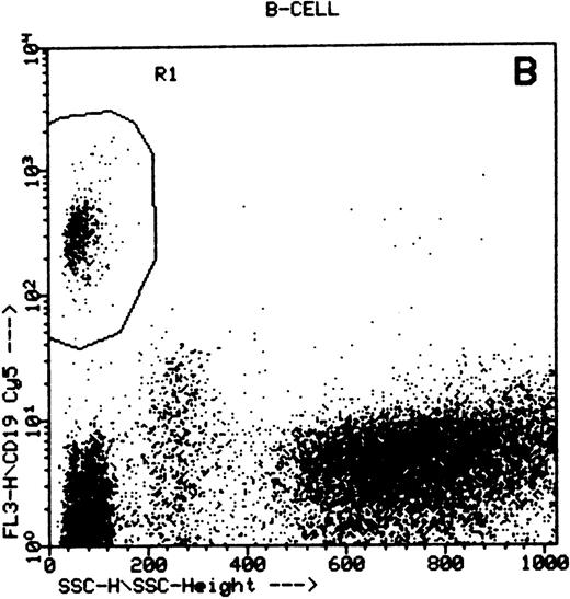 Fig. 1. Summary of flow cytometry gating procedures for the study of GPI-linked antigens (CD48 or CD59) by peripheral blood T cells, B cells, and NK cells. Plot (A) shows a region (R1) drawn around CD3+ cells with low side scatter characteristics; plot (B) shows a region (R1) drawn around CD19+ cells with low side scatter characteristics; plots (C and D) show the gating procedure for NK cells. An initial region or anchor gate (R2) is set around CD7+CD3− cells. This region is then applied to an FSC versus SSC plot and a second region (R3) drawn around the lymphocytes with low FSC and SSC characteristics. Only events (cells) meeting these two criteria are collected and analyzed.
