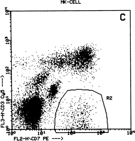 Fig. 1. Summary of flow cytometry gating procedures for the study of GPI-linked antigens (CD48 or CD59) by peripheral blood T cells, B cells, and NK cells. Plot (A) shows a region (R1) drawn around CD3+ cells with low side scatter characteristics; plot (B) shows a region (R1) drawn around CD19+ cells with low side scatter characteristics; plots (C and D) show the gating procedure for NK cells. An initial region or anchor gate (R2) is set around CD7+CD3− cells. This region is then applied to an FSC versus SSC plot and a second region (R3) drawn around the lymphocytes with low FSC and SSC characteristics. Only events (cells) meeting these two criteria are collected and analyzed.