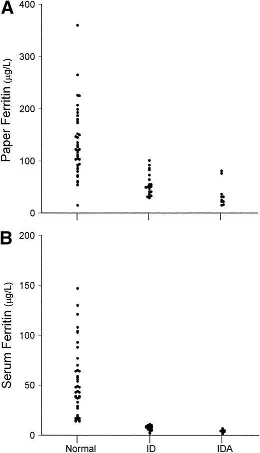 Fig. 4. Values of (A) dried paper samples of blood L-ferritin and (B) serum L-ferritin. Values are shown separately for normal subjects (N), subjects with ID, and subjects with IDA.