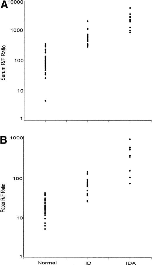 Fig. 6. Values of receptor/ferritin ratio (R/F ratio) from (A) serum and (B) dried paper samples of blood. Values are shown separately for normal subjects (N), subjects with ID, and subjects with IDA.