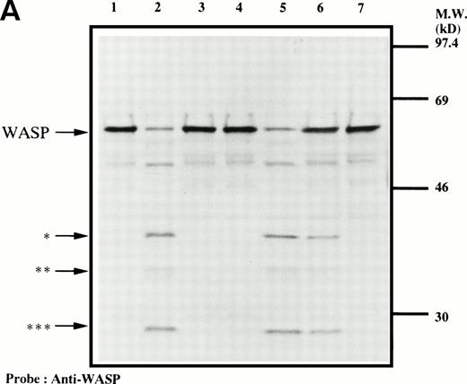 Fig. 4. Cleavage of WASP. (A) Platelets were incubated with either calpeptin (20 μmol/L) or DMSO (vehicle of calpeptin; final concentration, 0.1%) for 5 minutes. Platelets were then treated with calcium ionophore A23187 (1 μmol/L for 5 minutes) or dibucaine (1 mmol/L for 15 minutes) in the presence of 1 mmol/L CaCl2 or 5 mmol/L EGTA. Whole platelet lysates (1.5 × 107 cells/lane) were analyzed by 10% SDS-PAGE. Separated proteins were electrophoretically transferred from the gel onto nitrocellulose membranes. WASP was detected by immunoblotting with polyclonal antibody 503. The top arrow indicates the relative position of the intact 64-kD subunit of WASP. The lower arrows indicate the positions of apparently cleaved products of WASP. Lane 1, control, DMSO + CaCl2; lane 2, A23187 + CaCl2; lane 3, A23187 + EGTA; lane 4, A23187 + CaCl2 + calpeptin ; lane 5, dibucaine + CaCl2; lane 6, dibucaine + EGTA; lane 7, dibucaine + CaCl2 + calpeptin. (B) Cleavage of WASP during platelet aggregation. Platelets were stimulated with thrombin (1 U/mL) for 30 minutes with or without stirring. After the addition of EGTA (5 mmol/L) and EDTA (5 mmol/L), platelets were lysed by boiling in SDS sample buffer. WASP was detected by immunoblotting as described in Fig 1. Lane 1, resting platelets; lane 2, thrombin stimulation of platelets for 30 minutes with stirring; lane 3, thrombin stimulation for 30 minutes without stirring. The arrows indicate the same cleaved fragments of WASP as in (A).