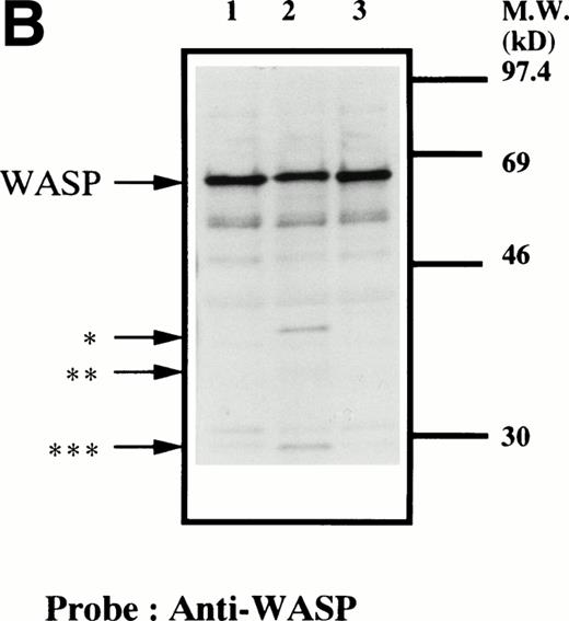 Fig. 4. Cleavage of WASP. (A) Platelets were incubated with either calpeptin (20 μmol/L) or DMSO (vehicle of calpeptin; final concentration, 0.1%) for 5 minutes. Platelets were then treated with calcium ionophore A23187 (1 μmol/L for 5 minutes) or dibucaine (1 mmol/L for 15 minutes) in the presence of 1 mmol/L CaCl2 or 5 mmol/L EGTA. Whole platelet lysates (1.5 × 107 cells/lane) were analyzed by 10% SDS-PAGE. Separated proteins were electrophoretically transferred from the gel onto nitrocellulose membranes. WASP was detected by immunoblotting with polyclonal antibody 503. The top arrow indicates the relative position of the intact 64-kD subunit of WASP. The lower arrows indicate the positions of apparently cleaved products of WASP. Lane 1, control, DMSO + CaCl2; lane 2, A23187 + CaCl2; lane 3, A23187 + EGTA; lane 4, A23187 + CaCl2 + calpeptin ; lane 5, dibucaine + CaCl2; lane 6, dibucaine + EGTA; lane 7, dibucaine + CaCl2 + calpeptin. (B) Cleavage of WASP during platelet aggregation. Platelets were stimulated with thrombin (1 U/mL) for 30 minutes with or without stirring. After the addition of EGTA (5 mmol/L) and EDTA (5 mmol/L), platelets were lysed by boiling in SDS sample buffer. WASP was detected by immunoblotting as described in Fig 1. Lane 1, resting platelets; lane 2, thrombin stimulation of platelets for 30 minutes with stirring; lane 3, thrombin stimulation for 30 minutes without stirring. The arrows indicate the same cleaved fragments of WASP as in (A).