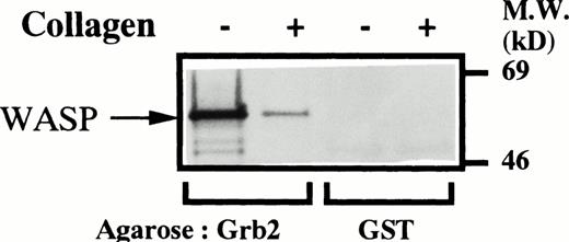 Fig. 5. Binding of GST-Grb2 but not GST to WASP. Platelets were stimulated in nonaggregating conditions and lysed as described for Fig1. Lysates before (−) and 5 minutes after (+) collagen stimulation were equally divided into four aliquots. The two samples from each of the lysates were incubated either with agarose-bound GST-Grb2 (10 μg, lanes 1 and 2) or GST (10 μg, lanes 3 and 4) on ice for 3 hours. After three washes in phosphate-buffered saline (150 mmol/L, pH 7.4) containing orthovanadate (200 μmol/L), the precipitates were incubated in SDS sample buffer. The SDS samples were subjected to Western blotting to detect WASP by polyclonal anti-WASP antiserum 503.
