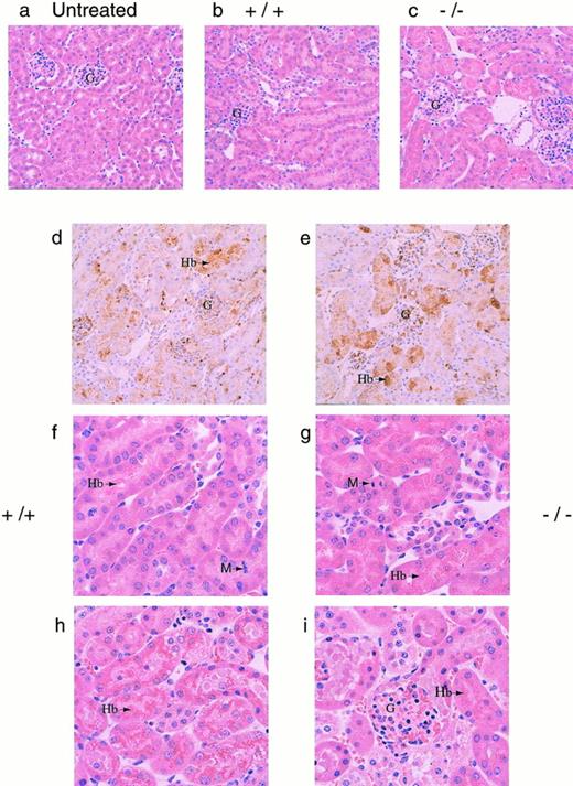 Fig. 4. (a through e) Histological sections of kidneys. Kidneys from mice were fixed in 10% formalin, embedded in paraffin, sectioned at 4 μm, and stained with hematoxylin and eosin. Representative sections as viewed under low power magnification (200×) from (a) a normal mouse (N), (b and c) phenylhydrazine-treated mice that survived, and (d and e) immunohistochemical analyses of kidney sections from phenylhydrazine-treated mice using a rabbit antiserum against mouse Hb. The presence of Hb was indicated by the brown precipitates. The glomeruli of phenylhydrazine-treated mice appeared relatively normal. Representative sections as viewed under high power magnification (400×). (f and g) Mice that survived the phenylhydrazine treatment; (h and i) mice that died during phenylhydrazine treatment. Hydropic degeneration, as evident by the numerous vacuoles, was observed. Arrows indicate Hb precipitates and M indicates metaphase cells found in histological sections of kidneys from phenylhydrazine-treated mice that survived. The mitotic index was calculated by randomly selecting 6 low power fields; within each low power field, the number of metaphase nuclei was counted against the total number of nuclei in 6 randomly chosen high power fields. Kidney sections from two mice of each genotype (+/+ and −/−) that survived the phenylhydrazine treatment were used to quantitate the mitotic index. The average mitotic index ± SD for +/+ mice was 18.8 ± 4.3 per 1,000 nuclei versus 4.78 ± 3.2 per 1,000 nuclei for −/− mice.
