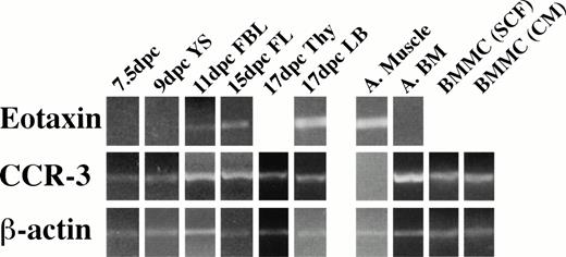 Fig. 2. Eotaxin and CCR-3 mRNA expression in embryonic tissues. RT products were prepared from RNA isolated from frozen tissues. Briefly, 1 μg of total RNA was reverse transcribed, and equalized amounts of the cDNA generated were amplified with β-actin (20 cycles), eotaxin (30 cycles), and CCR-3 (32 cycles) primers to generate fragments of 348, 108, and 454 bp, respectively. Adult tissues (A) were used as a control.