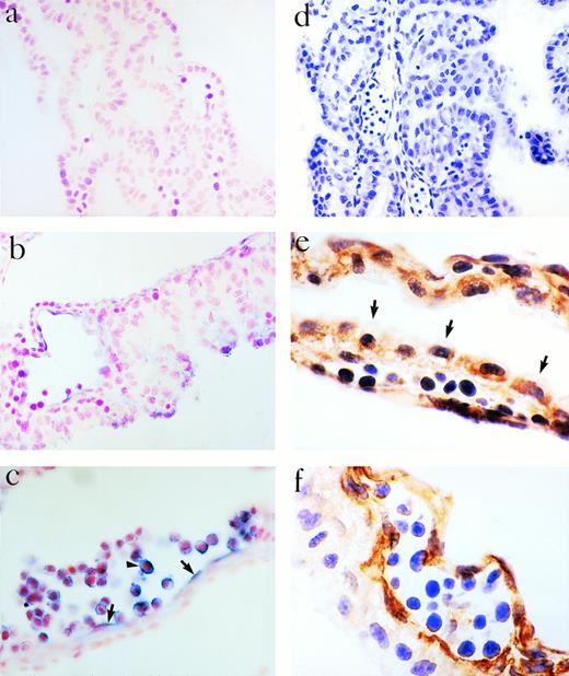 Fig. 1. Expression of eotaxin in YS at 10.5 dpc. Eotaxin mRNA was assessed by in situ hybridization using a sense probe (a) or antisense probe (b and c). The endothelium (arrows, c) and cells in the vessel lumen (arrowhead, c) are positive. Immunoperoxidase staining was performed with a control antibody (d), antieotaxin MoAb (e), or a MoAb to CD34 (f). The visceral layer of cells, the endothelium, and primitive blood cells express eotaxin (e). In (e), the arrows identify the edge of the visceral cell layer. Magnifications are 100× (d), 400× (a, c, and f), and 1,000× (b and e).