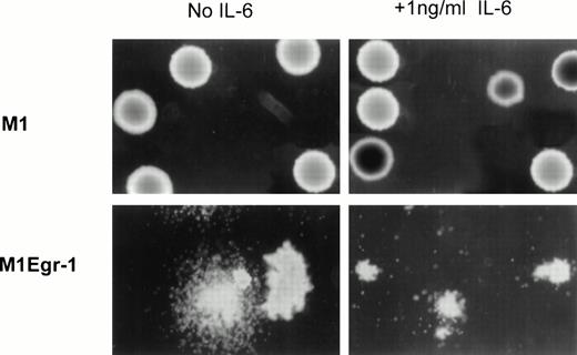 Fig. 3. Photomicrographs of M1 and M1Egr-1 colonies in soft agar. Representative photomicrographs (original magnification × 100) of M1 and M1Egr-1 colonies 7 days after the cells were seeded in soft agar, in the absence or presence of IL-6. The number of colonies for the different cell types is presented in Table 2.