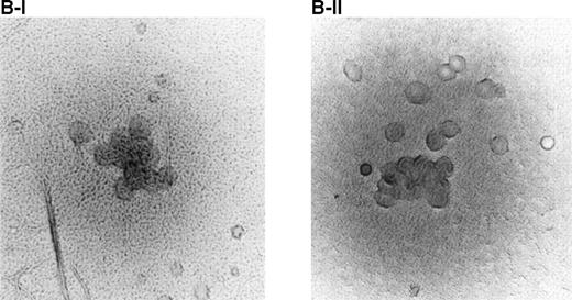 Fig. 5. Effect of BAH-1 MoAb on human CFU-MK colonies. (A) CD34+ bone marrow cells were plated at 5 × 103/mL in the fibrin clot system (see the Materials and Methods). Results are expressed as the means ± SEM of megakaryocyte colonies. Experiments were performed in triplicate in four assays. *Statistically significant compared with PBS (P < .05). (B) Photographs of CFU-MK colonies in the presence of BAH-1 (B-I) or TPO (B-II).