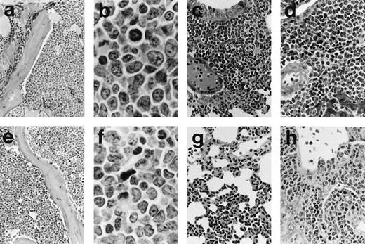 Fig. 3. Histology of representative leukemias arising in MSCV-FL mice. Hematoxylin and eosin-stained sections are shown for mouse 196 with B-lymphoid leukemia (a through d) and for mouse 199 with biphenotypic leukemia (e through h). (a) The bone marrow architecture of mouse 196 is effaced by a blast cell infiltrate that extends into the adjacent muscle (original magnification × 185). (b) At higher magnification, blast cells in the bone marrow of mouse 196 can be seen to be predominantly medium-sized with round to oval nuclei, moderately basophilic cytoplasm, and occasionally with prominent nucleoli; mitotic figures are abundant (original magnification × 1,115). (c) Lung of mouse 196 showing diffuse interstitial and nodular peribronchial parenchymal infiltrates (original magnification × 270). (d) Liver of mouse 196 showing perivascular accumulations of blast cells as well as some blast cells around bile ducts (original magnification × 370). (e) Bone marrow of mouse 199 showing blast cells of variable size occupying the hematopoietic space; scattered erythroblasts and megakaryocytes are present (original magnification × 185). (f) At higher magnification, blast cells in the bone marow of mouse 199 of variable shape with irregular nuclei and one to three distinct nucleoli can be seen to be intermixed with granulocytic cells of various maturational stages (original magnification × 1,115). (g) Lung of mouse 199 showing diffuse interstitial infiltrates of blast cells and granulocytes (original magnification × 270). (h) Liver of mouse 199 showing polymorphous tumor infiltrates, sometimes with pronounced granulocytic differentiation, mainly in periportal areas (original magnification × 370).