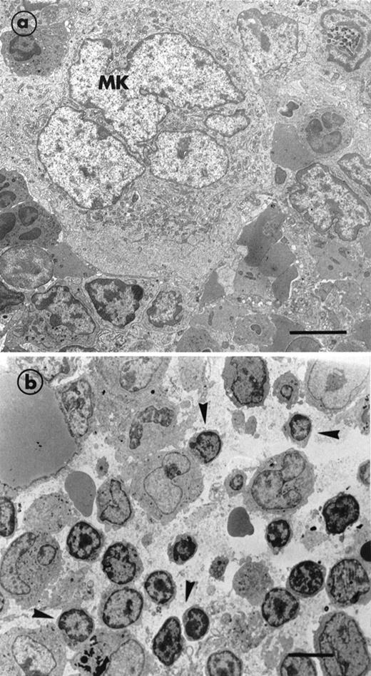 Fig. 1. Electron micrographs illustrating the bone marrow of a normal mouse and a MIIb-tk transgenic mouse both treated with GCV. (a) A mature MK in a nontransgenic mouse surrounded by numerous cells belonging to the granulocytic lineage. An erythroblastic islet can also be seen in the bottom right hand corner. (b) MIIb- tk bone marrow after GCV treatment showing the intense disorganization of the marrow. Note the enhanced presence of small mononuclear cells (arrowheads) having a high nucleus-cytoplasm ratio. MK were absent. Bars = 5 μm.