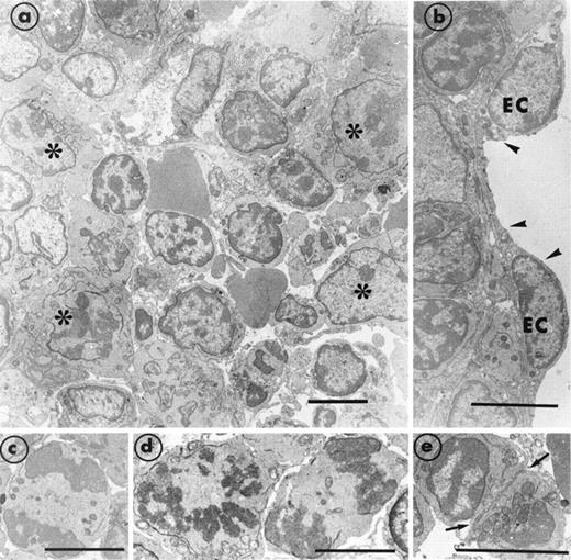 Fig. 3. Section of bone marrow obtained from a transgenic MIIb-tk mouse 4 days after discontinuing GCV treatment. (a) The bone marrow has become reorganized and compact. Numerous maturing cells (*) are present. However, mature MK were still rarely observed. (b) A well-preserved endothelial cell (EC) is delimiting a vascular sinus (arrowheads). (c through e) Typical examples of cells in mitosis and in division (arrows) illustrate the intense cell proliferation. Bars = 5 μm.