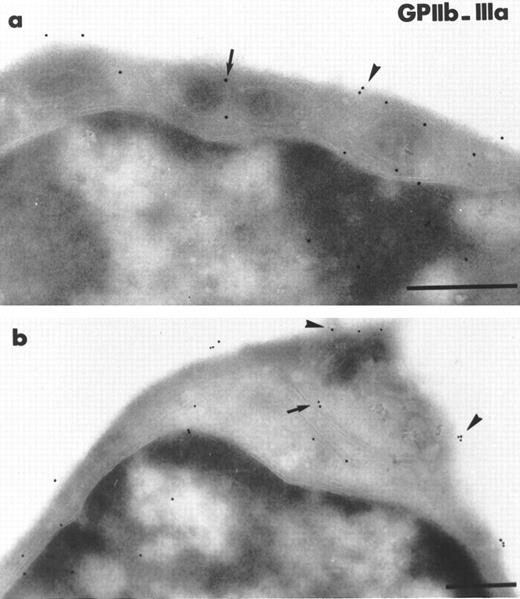Fig. 4. Two illustrations of MK progenitors characterized by immunogold staining with polyclonal antibody reacting with murine GPIIb-IIIa on ultrathin frozen sections of MIIb-tk bone marrow 4 days after discontinuing GCV. The size of these MK progenitors is between 10 to 15 μm in diameter. (a) Example of an immature MK having a high nucleus/cytoplasm ratio and a thin cytoplasmic rim. Some staining for GPIIb-IIIa is visible on the plasma membrane (arrowheads) and on the membrane of the few -granules present (arrows). (b) In this immature MK characterized by the presence of GPIIb-IIIa on the plasma membrane (arrowheads), the gold particles are also associated with internal membranes possibly representing a developing demarcation membrane system (arrow). Bars = 0.5 μm.