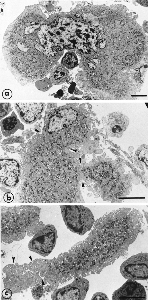 Fig. 7. Illustration of the step leading to the final maturation of MK from the deformation of the cytoplasm to the separation of proplatelet fragments. (a) A further example of cytoplasm and nucleus deformation of a large mature MK. (b) An extremity of a mature MK shows deformation and constriction zones (arrowheads) and the presence of projections suggesting the subsequent and early separation of the proplatelet fragments. (c) An elongated proplatelet fragment separated from the cytoplasm. As indicated by arrowheads, this particular zone is fragmenting into platelet-size fragments and is still surrounded by the organelle-free zone. Bars = 5 μm.
