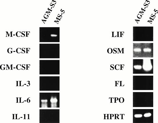 Fig. 4. RT-PCR analysis of expression of various cytokines on AGM-S3 and MS-5 cells.