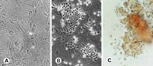 Fig. 1. (A) Phase microscopy of AGM-S3 cells established. (B) Appearance of cobblestone-like colonies generated in the coculture of human CB CD34+ cells with AGM-S3 cells at day 14 of culture. (C) Appearance of a part of a mixed hematopoietic colony produced by the cells harvested from the coculture of CD34+CD38− cells with AGM-S3 cells at week 6 of culture.