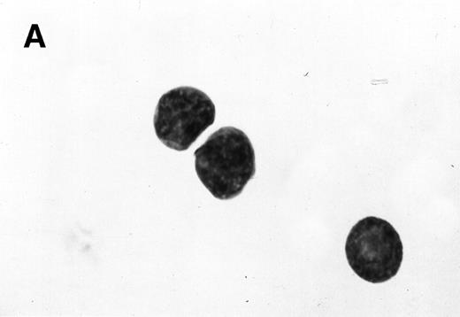 Fig. 3. Morphology of sorted CD34+ cells obtained from MPB. The regions R3 (CD38−/low in A), R4 (CD382+ in B), and R5 (CD383+ in C) were stained with Wright Giemsa’s stain, visualized by light microscopy, and photographed at 1,000× magnification. Data show one representative experiment of six.