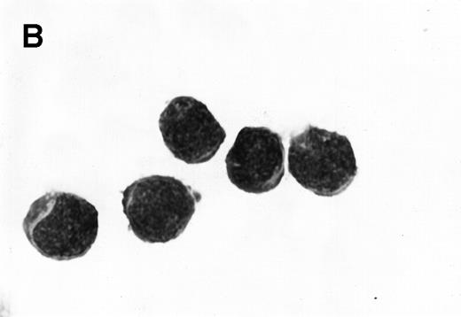 Fig. 3. Morphology of sorted CD34+ cells obtained from MPB. The regions R3 (CD38−/low in A), R4 (CD382+ in B), and R5 (CD383+ in C) were stained with Wright Giemsa’s stain, visualized by light microscopy, and photographed at 1,000× magnification. Data show one representative experiment of six.