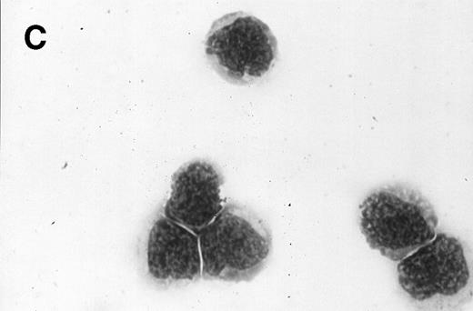 Fig. 3. Morphology of sorted CD34+ cells obtained from MPB. The regions R3 (CD38−/low in A), R4 (CD382+ in B), and R5 (CD383+ in C) were stained with Wright Giemsa’s stain, visualized by light microscopy, and photographed at 1,000× magnification. Data show one representative experiment of six.