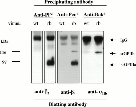 Fig. 5. Immunoprecipitation of srGPIIb and srGPIIIa by human antibodies specific for the alloantigens PlA1 (HPA-1a), Pena (HPA-4b), and Baka (HPA-3a). As predicted from the known amino acid sequences of srGPIIb and srGPIIIa, anti-PlA1 and anti-Pena recognized srGPIIIa and anti-Baka recognized srGPIIb. No bands were obtained with normal serum (not shown).