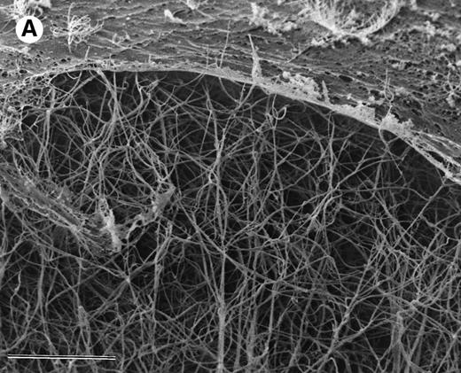 Fig. 3. SEM of aged plasma clots. Plasma clots (50 μL) were formed by addition of thrombin (to 0.5 NIH units/mL) and CaCl2 (to 20 mmol/L) to citrated human plasma and then transferred to cylindrical wells milled in carbon planchettes. After 3 hours of incubation, clots were overlaid with HBS, pH 7.4. After a 30-minute permeation period, excess liquid was removed and each sample was dehydrated, critical point-dried, and sputter-coated as described in Materials and Methods. Samples were examined in a Philips Model 515 scanning electron microscope, and micrographs were taken at magnifications of 1,850× (A; bar = 10 μm) and 18,300× (B; bar = 1 μm).
