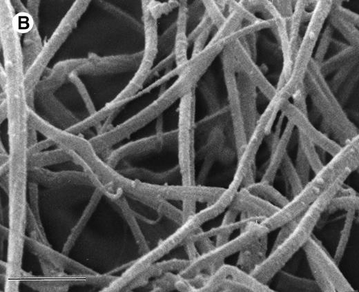 Fig. 3. SEM of aged plasma clots. Plasma clots (50 μL) were formed by addition of thrombin (to 0.5 NIH units/mL) and CaCl2 (to 20 mmol/L) to citrated human plasma and then transferred to cylindrical wells milled in carbon planchettes. After 3 hours of incubation, clots were overlaid with HBS, pH 7.4. After a 30-minute permeation period, excess liquid was removed and each sample was dehydrated, critical point-dried, and sputter-coated as described in Materials and Methods. Samples were examined in a Philips Model 515 scanning electron microscope, and micrographs were taken at magnifications of 1,850× (A; bar = 10 μm) and 18,300× (B; bar = 1 μm).