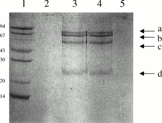 Fig. 6. SDS-PAGE analysis of the proteins bound to suPAR-Sepharose. Lane 1, molecular weight markers; lane 2, suPAR-Sepharose incubated with PBS; lane 3, suPAR-Sepharose incubated with plasma; lane 4, suPAR-Sepharose incubated with scuPA and plasma; lane 5, suPAR-Sepharose incubated with scuPA and PBS.